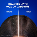 Head & Shoulders Vitality Anti-Dandruff Shampoo Hair Thickening 600ml