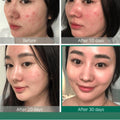 The Ordinary AHA 30% and BHA 2% Peeling Solution, Exfoliating Facial Treatment, 30ml