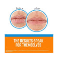 Best Lip Balm for Dry Lips Cooling O'Keeffe's Lip Repair 4.2g