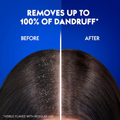 Head & Shoulders Complete Care Anti-Dandruff Shampoo, 190 ml