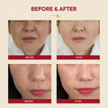 K-Secret Seoul 1988 Essence - Snail Mucin 97%, Rice Extract, 100 ml