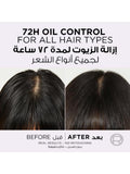 L'Oreal Paris Elvive Hyaluron Pure Shampoo for Oily Scalp & Dry Ends - 200ml