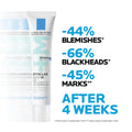 La Roche-Posay Effaclar Duo+M Face Moisturizer, Niacinamide and Salicylic Acid, Breakout-Prone Skin