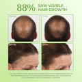 Bosley Healthy Hair & Scalp Follicle Energizer Leave-In Serum with Biotin, Caffeine & Panthenol 30ml