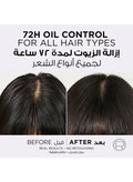 L'Oreal Paris Elvive Hyaluron Pure Purifying Shampoo Salicylic Acid Oily Scalp 400 ml, Pack of 2