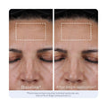OBAGI ELASTIDERM Filler Concentrate Facial Treatment for Fine Lines and Wrinkles, 20 ml