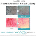 Medicube Azelaic Acid Niacinamide Deep Clean Foam Cleanser 120 g