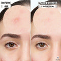 Garnier SkinActive Fast Clear Invisible Hydrocolloid Pimple Patches, 22 Count