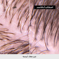 L'Oreal Professionnel Scalp Advanced Dermo-Purifier Shampoo 3% AHA Salicylic Acid 300 ml