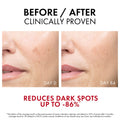 Vichy Liftactiv B3 Dark Spot Serum, Lightweight Niacinamide & Glycolic Acid Formula, 30 ml