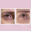 Youth Lab Peptides Hydragel Eye Patches Monodose with Peptides and Hyaluronic Acid