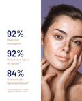 Soskin Dark Spot Brightening Serum, Even-Tone Care, 30 ml