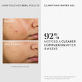 Murad Blemish Clarifying Water Gel Hydrating Facial Moisturizer with Hyaluronic Acid and Salicylic Acid, 60 ml
