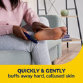 Dr.Scholl's Electronic Foot File Callus Remover with Rotating Roller Head, Batteries Included