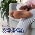 Dr.Scholl's Electronic Foot File Callus Remover with Rotating Roller Head, Batteries Included