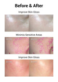 JOVS Red LED Light Therapy Wireless Panel for Face and Body