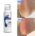 Footlogix Cracked Heel Formula Mousse Urea Evening Primrose Oil 125ml