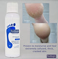 Footlogix Cracked Heel Formula Mousse Urea Evening Primrose Oil 125ml