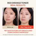 T'else Red Orange Niacinamide Toner Liquid Brightening Facial Toner 150ml