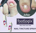 Footlogix Nail Tincture Spray Spiraleen Strengthening Formula 50ml