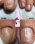 Footlogix Nail Tincture Spray Spiraleen Strengthening Formula 50ml