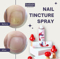 Footlogix Nail Tincture Spray Spiraleen Strengthening Formula 50ml