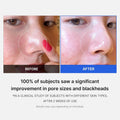 Medicube Zero Pore Pad 2.0 Blemish-Clearing Skin Pads for Oily Skin