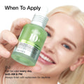 Anua Azelaic Acid 10 Hyaluron Redness Soothing Face Serum, 30 ml