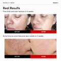 Frankly Retinol Cream 0.3% Face Cream Ceramides and Ginseng 20ml