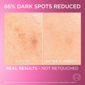 Loreal Glycolic Bright Melasyl Anti-Dark Spot Serum 15 ml