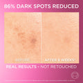 Loreal Glycolic Bright Melasyl Anti-Dark-Spot Serum with Niacinamide 30ml