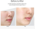 Medi-Peel Deep VC Ultra Cream Collagen Vitamin Complex Sensitive Skin Cream