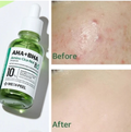 MediPeel AHA BHA Cica-Nol B5 Ampoule, 28-Day Exfoliating Soothing Treatment