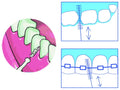 Best Interdental Brush Slim 1.3mm Deep Cleaning Foramen 6 Pack