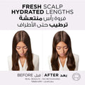 Purifying Scalp Shampoo for Itchy Dry Scalp Hyaluronic Acid L'Oreal 600ml