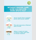 Garnier Invisible Hydrocolloid Patches for Pimple Treatment - 22 Count (10mm & 12mm)