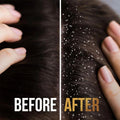 Anti-Dandruff Shampoo and Conditioner 2-in-1 Scalp Care Pantene 390ml