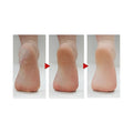 Jackie Foot Callus Remover Tool Dead Skin Removal Heel Care