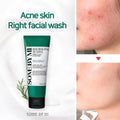 30 Day Miracle Foaming Facial Cleanser AHA BHA PHA Some By Mi 100ml