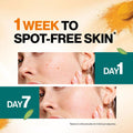 Himalaya Turmeric Brightening Cream for Skin Tone Support, 50g