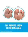 Intensive Moisture Foot Mask for Dry Skin by O'Keeffe's, 1 Pair