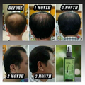 Hair Setting Lotion Scalp Nourishing Formula Green Wealth 120ml