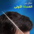 Anti-Dandruff Shampoo Oily Scalp Lemon Extract Head & Shoulders 400ml