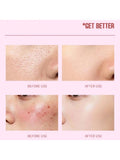 Face Serum for Dry Skin Soothing Aloe Vera Heres B2uty 30ml