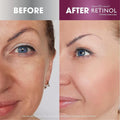 Retinol Eye Balm Vitamin A C Peptides Squalane 3.5ml