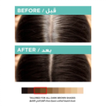 L'Oreal Paris Root Concealer Spray, Dark Brown, 75ml