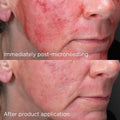 Facial Moisturizer with SPF 50 Mineral Smart Blend Image Skincare 48g
